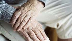 Como minimizar o envelhecimento precoce das mãos