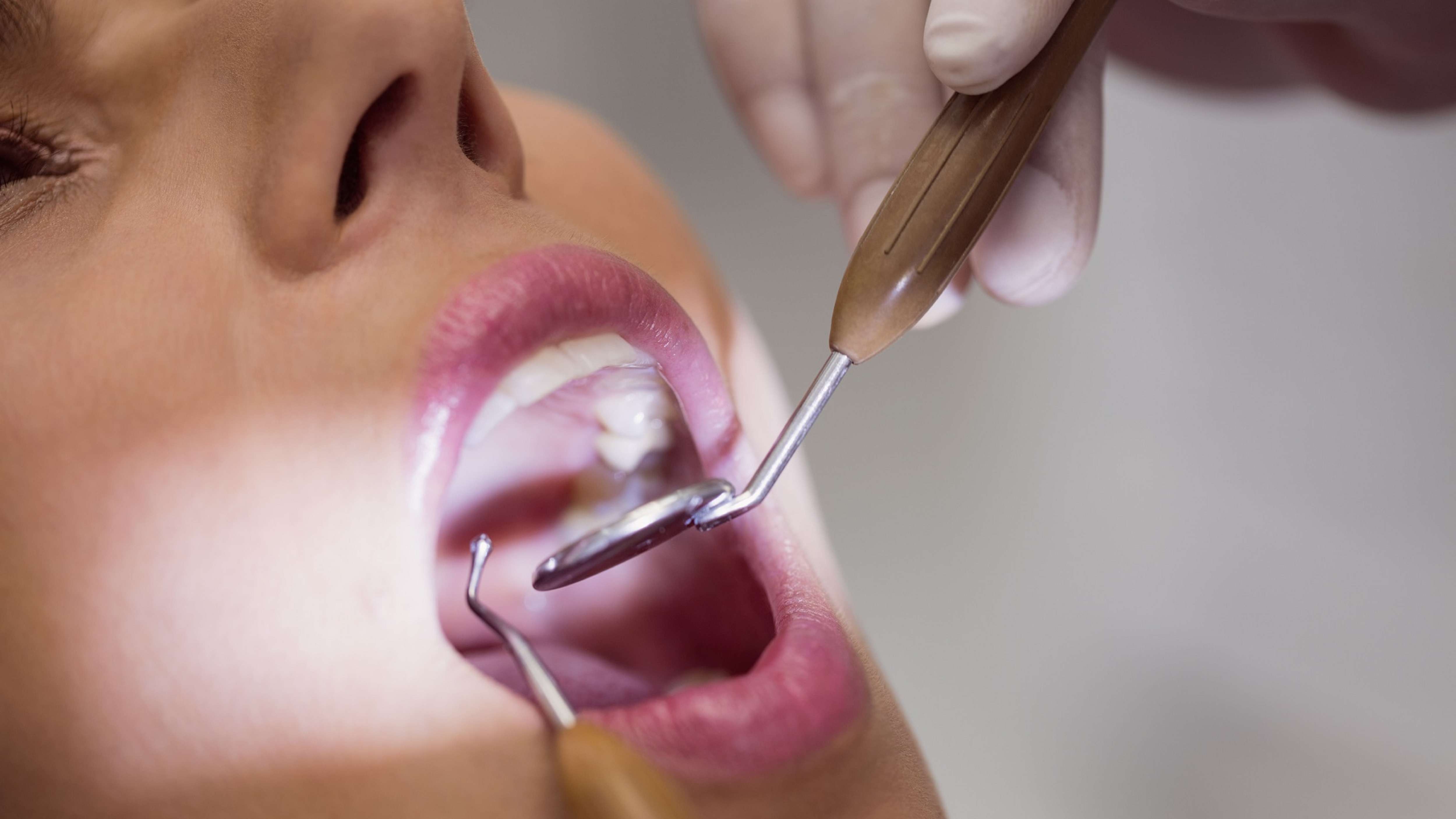 Câncer Bucal: Dentista alerta sobre sintomas e prevenção da doença