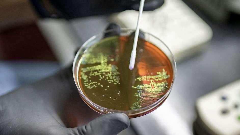 OMS atualiza lista de bactérias que mais ameaçam a saúde humana