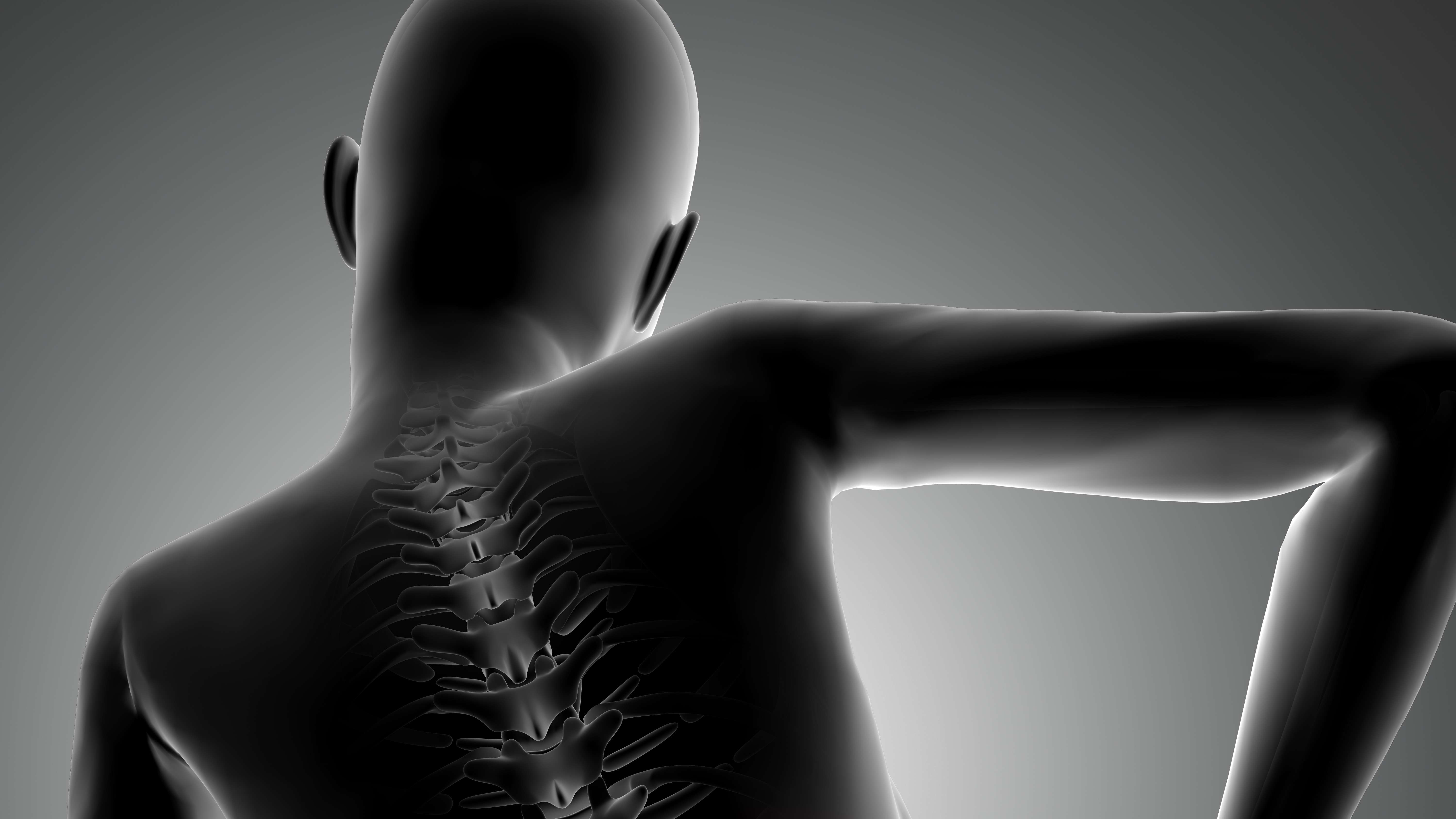 Hérnia de disco, prevenção, sintomas e tratamento para a recuperação e qualidade de vida