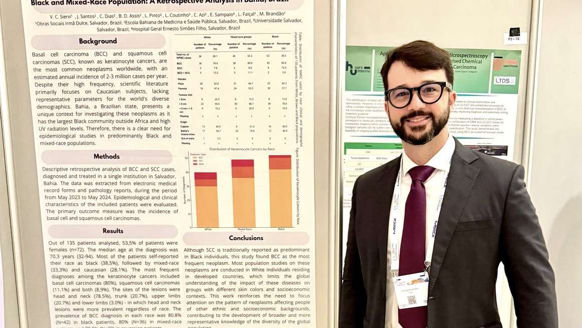 Estudo sobre câncer de pele em pessoas negras e pardas é apresentado no Congresso Mundial de Melanoma, na Grécia