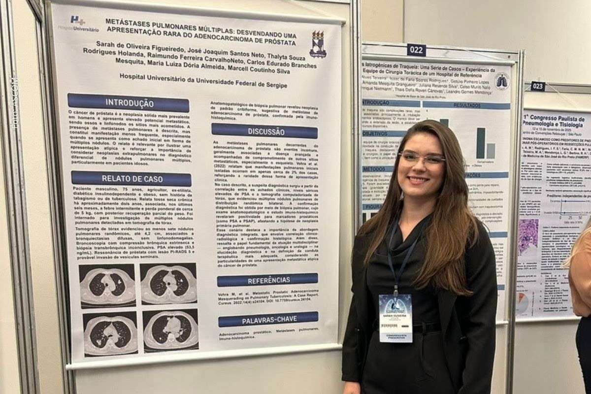 Residente do HU-UFS é única brasileira selecionada para curso internacional da American Thoracic Society em 2026