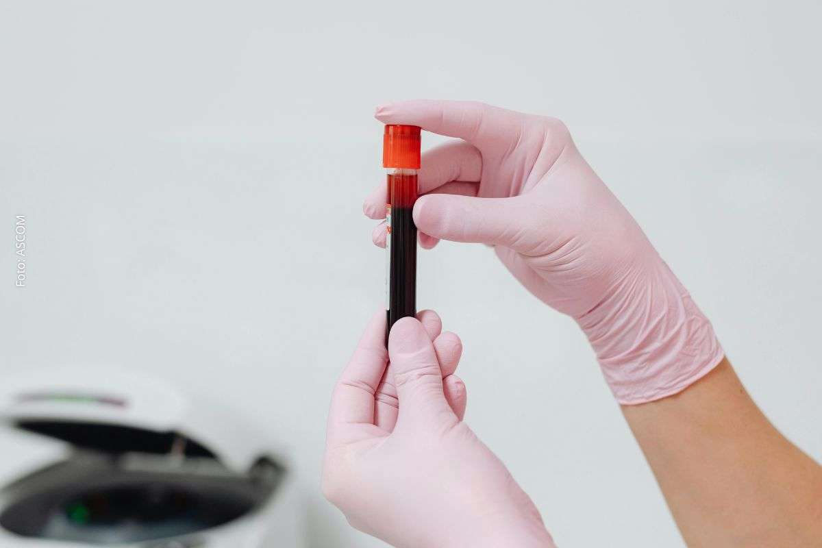 Exame de sangue com biomarcadores amplia detecção precoce do câncer de pâncreas e pode impactar tratamento