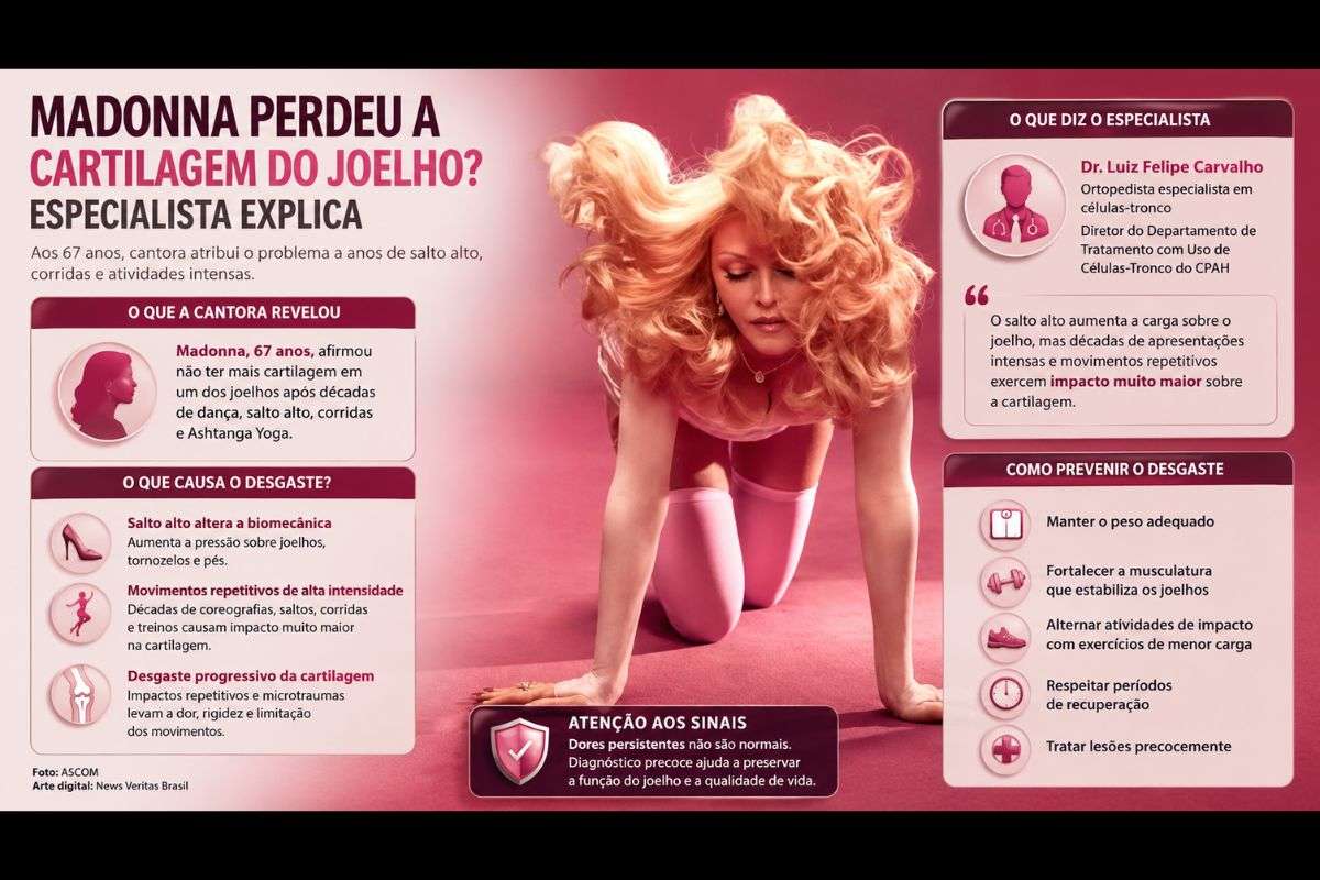 Madonna perdeu a cartilagem do joelho por causa do salto alto? Especialista explica os fatores por trás do desgaste articular