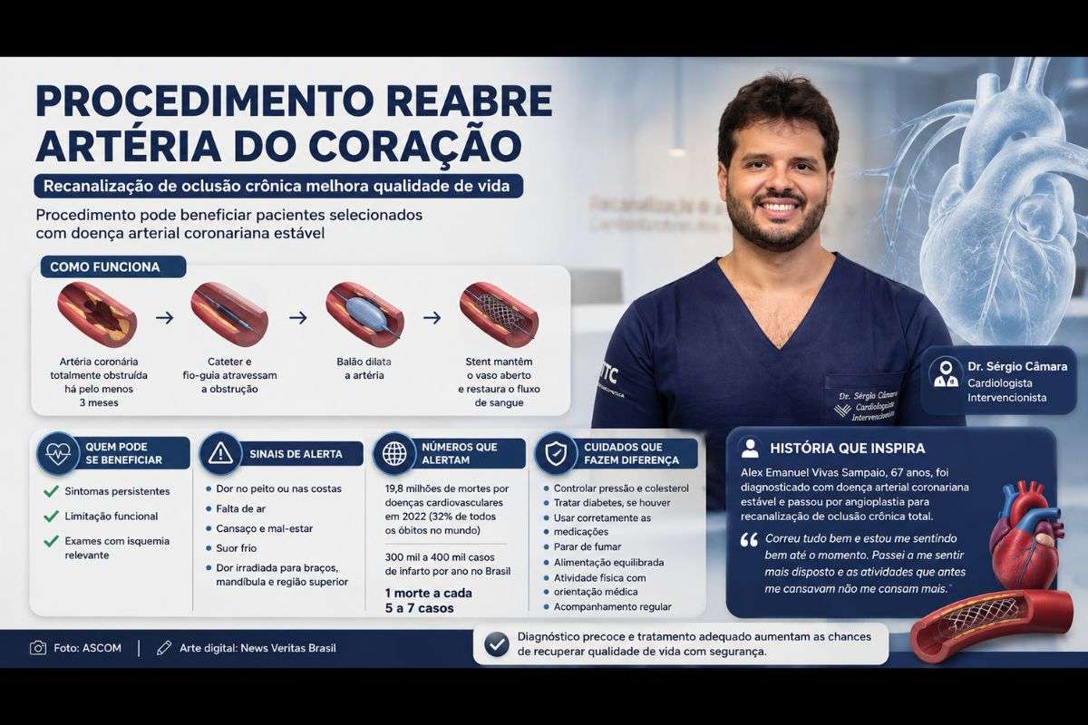 Procedimento para desobstrução de artéria do coração melhora qualidade de vida e amplia opções de tratamento para doença coronariana